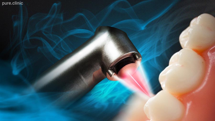 گستردگی استفاده از لیزر در دندانپزشکی